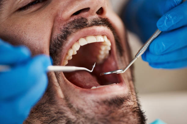 Best Broken or Cracked Tooth Emergency Dentist in Scotts Hill, TN