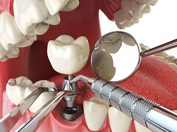Best Holiday Emergency Dentist in Scotts Hill, TN